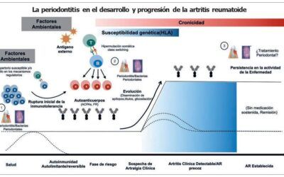 ARTRITIS REUMATOIDE Y PERIODONTITIS: ASOCIACIÓN, MANEJO E IMPLICACIONES EN LA CLÍNICA DENTAL.